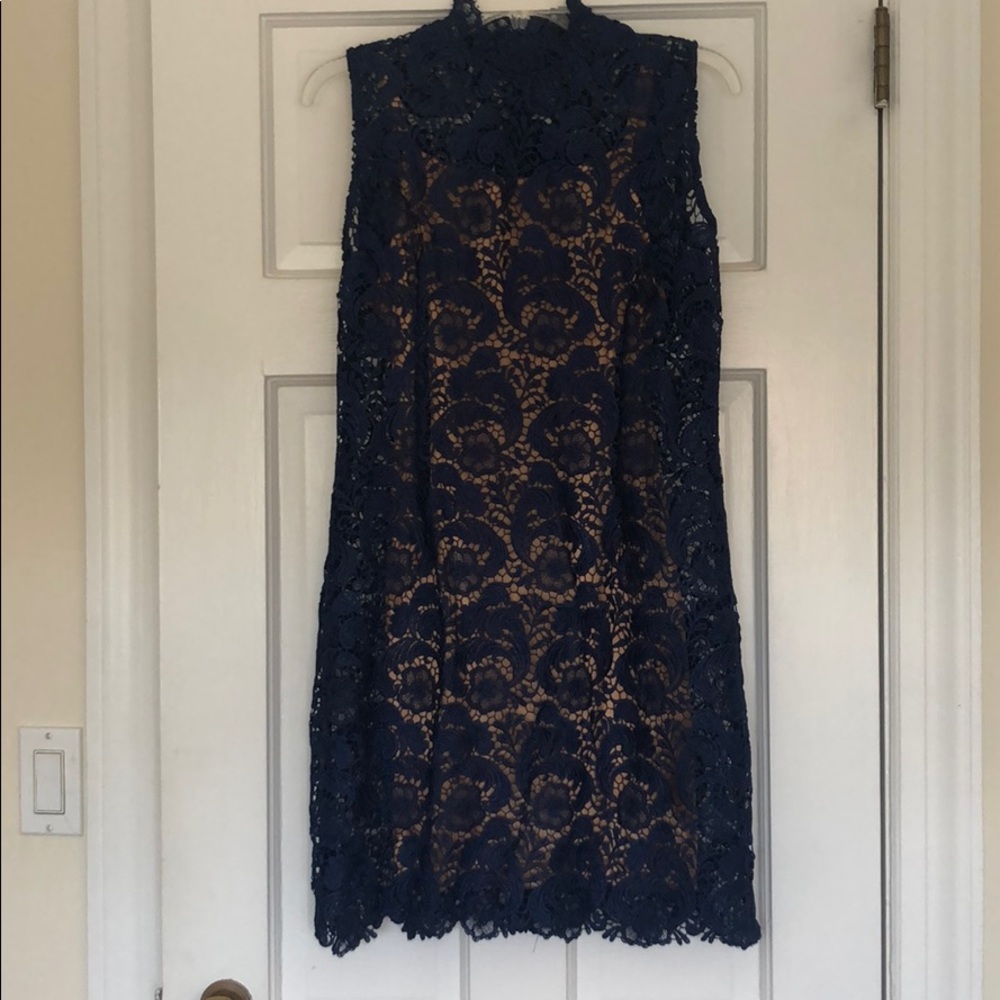 LACE DRESS 💙 - Picture 2 of 6
